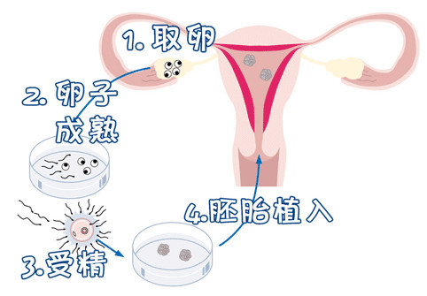 供卵代生医院代生包成功